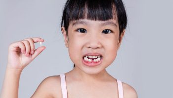 Tooth Extraction for Kids: What to Expect When Having Your Teeth Removed?